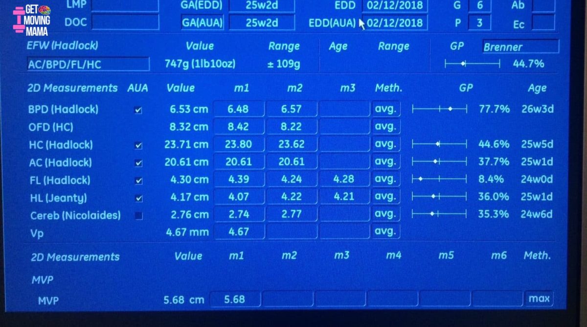 A picture of measurements taken for a high risk pregnancy monitoring the growth of a small for gestational age fetus.