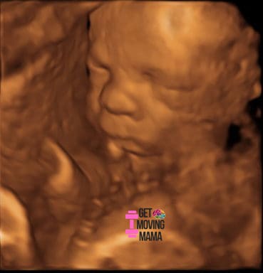 A sepia colored ultrasound picture showing a baby at 20 weeks gestation.